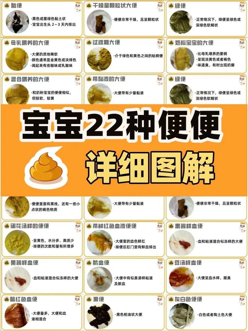 新生儿一天不拉大便正常吗？-第3张图片-郑州医学网