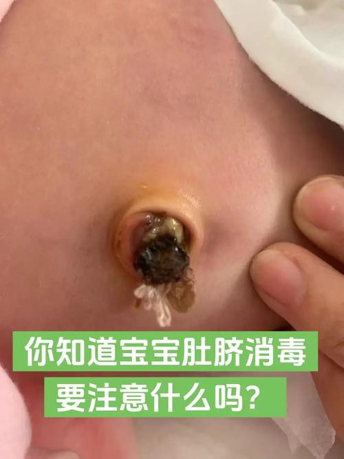 新生儿脐带到底能不能用酒精擦？-第2张图片-郑州医学网
