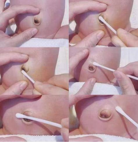 新生儿脐带到底能不能用酒精擦？-第3张图片-郑州医学网