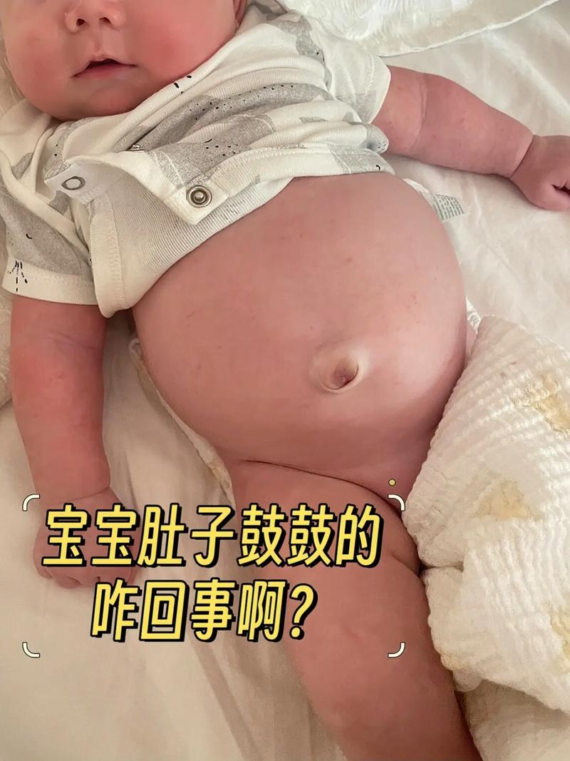 新生儿肚子硬还是软算正常?-第1张图片-郑州医学网 新生儿肚子硬还是软算正常?-第1张图片-郑州医学网
