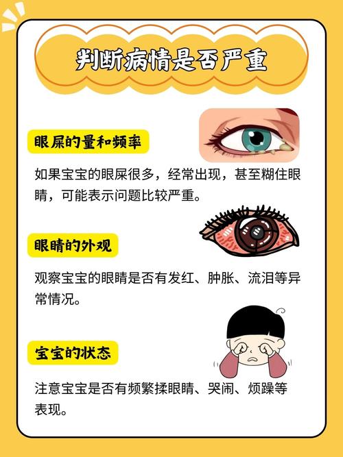 新生儿黄眼屎是上火还是生病了？-第3张图片-郑州医学网