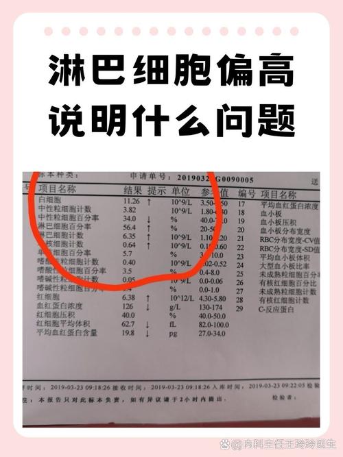 新生儿淋巴细胞绝对值偏高是何原因?-第2张图片-郑州医学网 新生儿淋巴细胞绝对值偏高是何原因?-第2张图片-郑州医学网