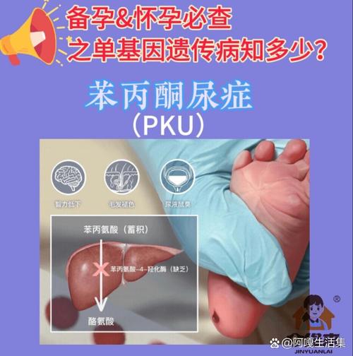 新生儿苯丙酮尿症是什么病？-第3张图片-郑州医学网