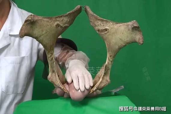 孕期B超到底该做几次?-第2张图片-郑州医学网 孕期B超到底该做几次?-第2张图片-郑州医学网