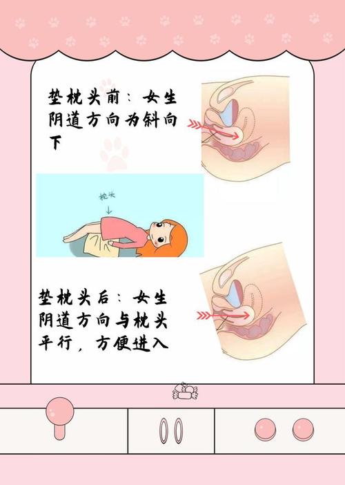 孕期阴道痛是何原因？-第1张图片-郑州医学网