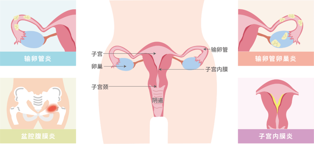 孕期阴道痛是何原因？-第2张图片-郑州医学网