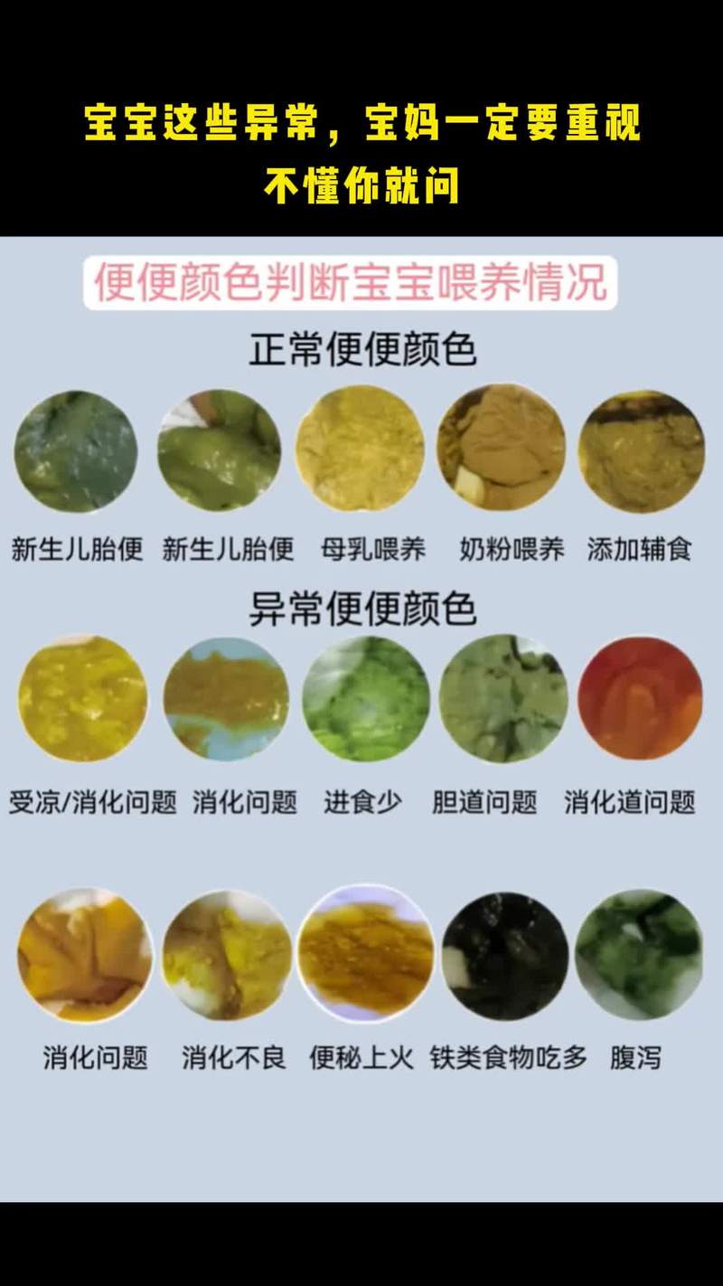 新生儿一天拉几次算正常？-第2张图片-郑州医学网
