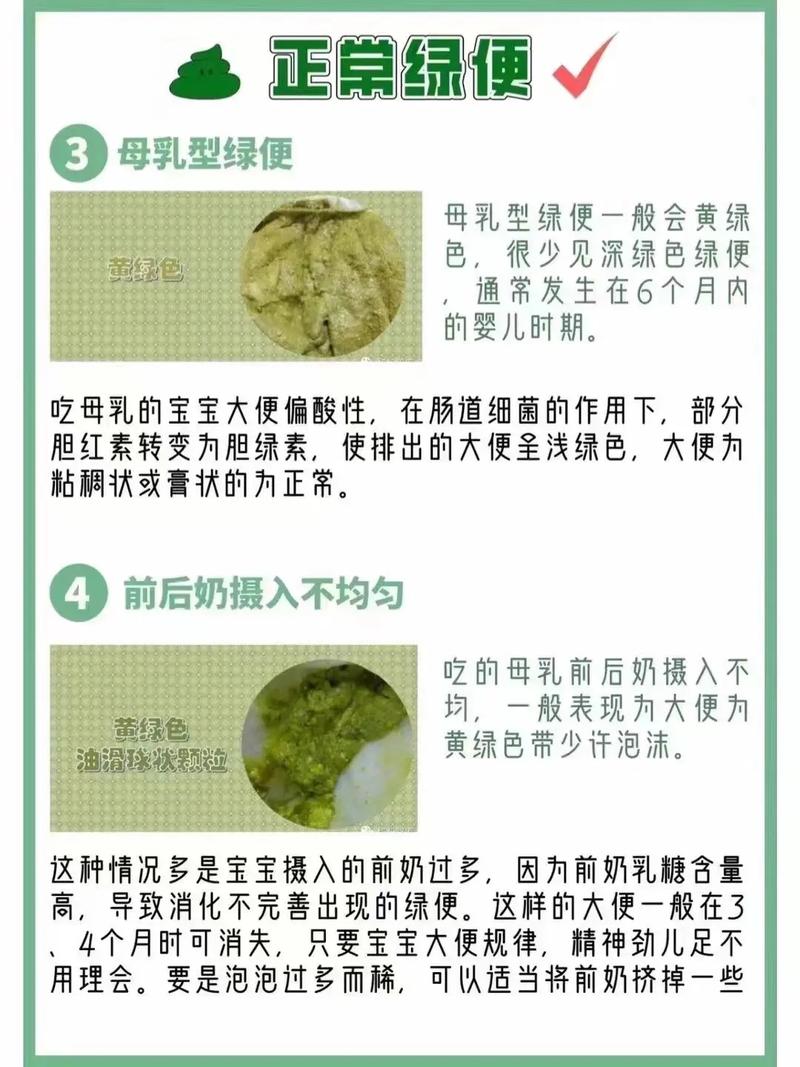 新生儿便便发绿是何原因？-第2张图片-郑州医学网