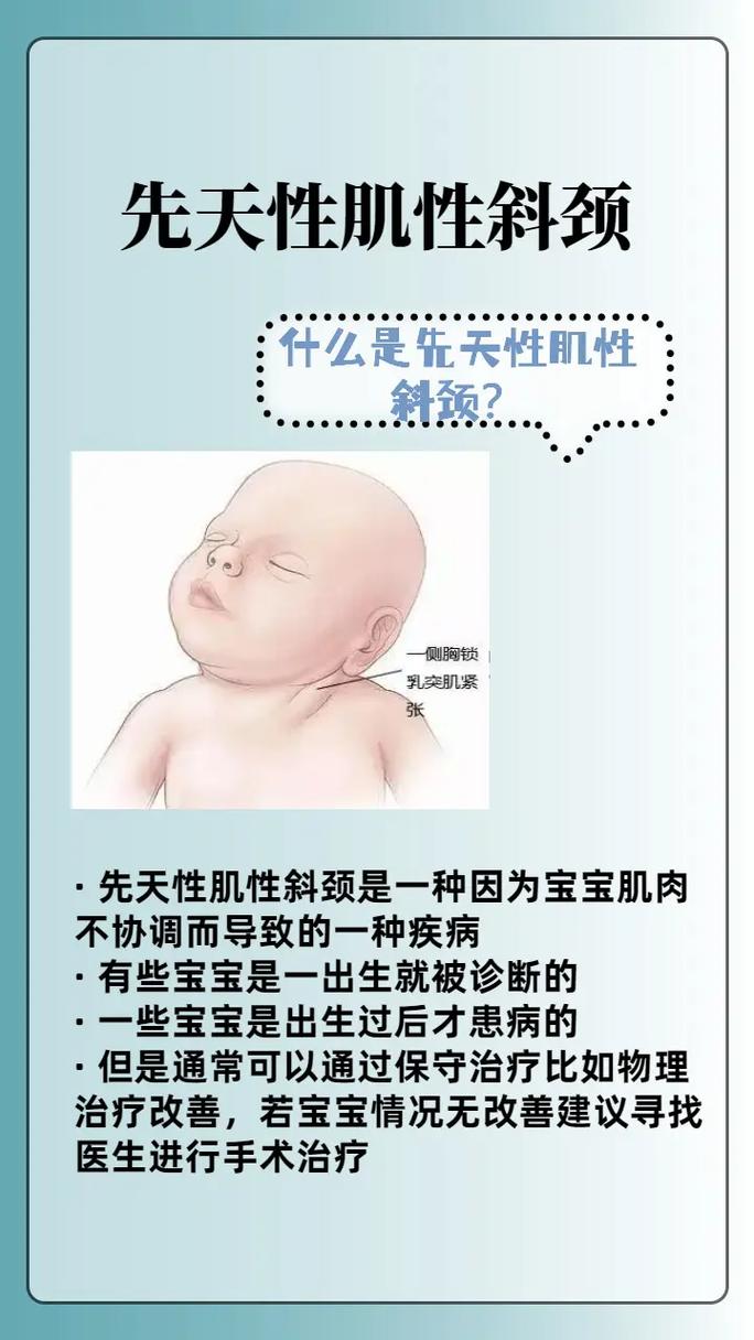 新生儿先天性斜颈能治好吗?-第2张图片-郑州医学网 新生儿先天性斜颈能治好吗?-第2张图片-郑州医学网