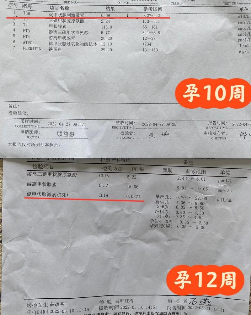 怀孕期间甲状腺激素偏低-第2张图片-郑州医学网