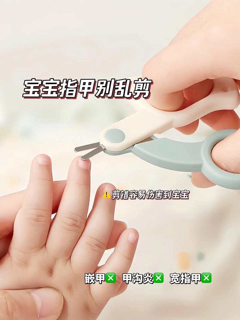 新生儿月子里能剪指甲吗?-第2张图片-郑州医学网 新生儿月子里能剪指甲吗?-第2张图片-郑州医学网