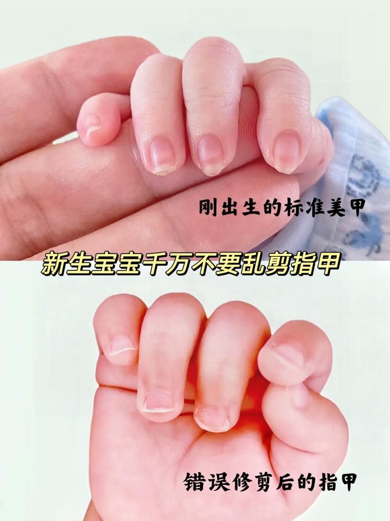 新生儿月子里能剪指甲吗?-第1张图片-郑州医学网 新生儿月子里能剪指甲吗?-第1张图片-郑州医学网
