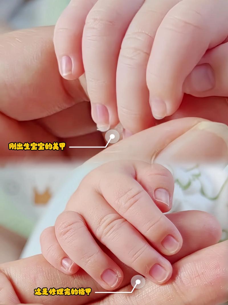 新生儿月子里能剪指甲吗？-第3张图片-郑州医学网