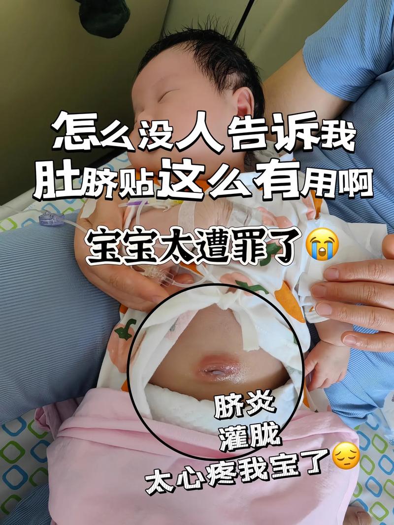 新生儿肚脐多久能完全好?-第1张图片-郑州医学网 新生儿肚脐多久能完全好?-第1张图片-郑州医学网