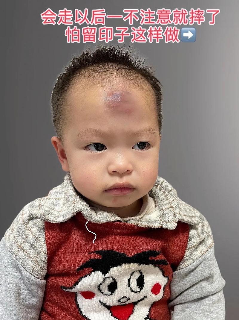 新生儿脸上发青是怎么回事-第2张图片-郑州医学网