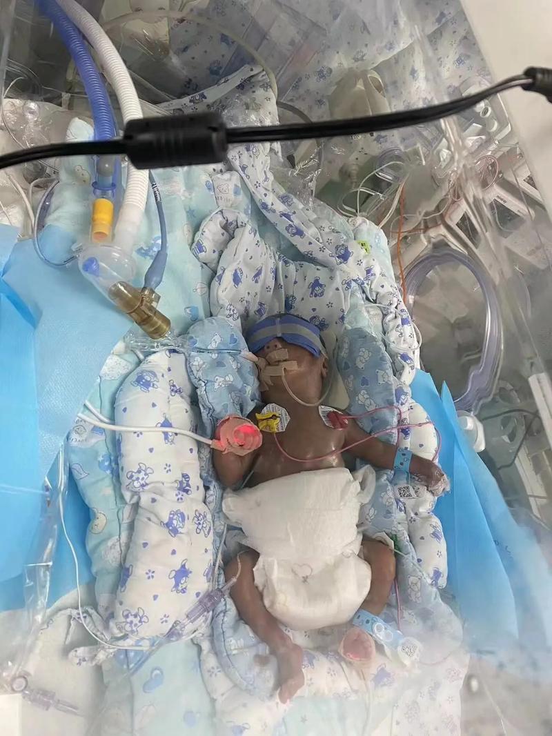 新生儿什么情况需进保温箱？-第3张图片-郑州医学网