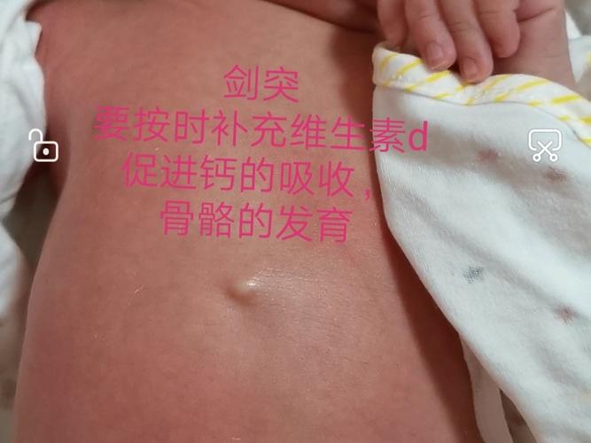新生儿胸口中间凸起是何原因？-第3张图片-郑州医学网