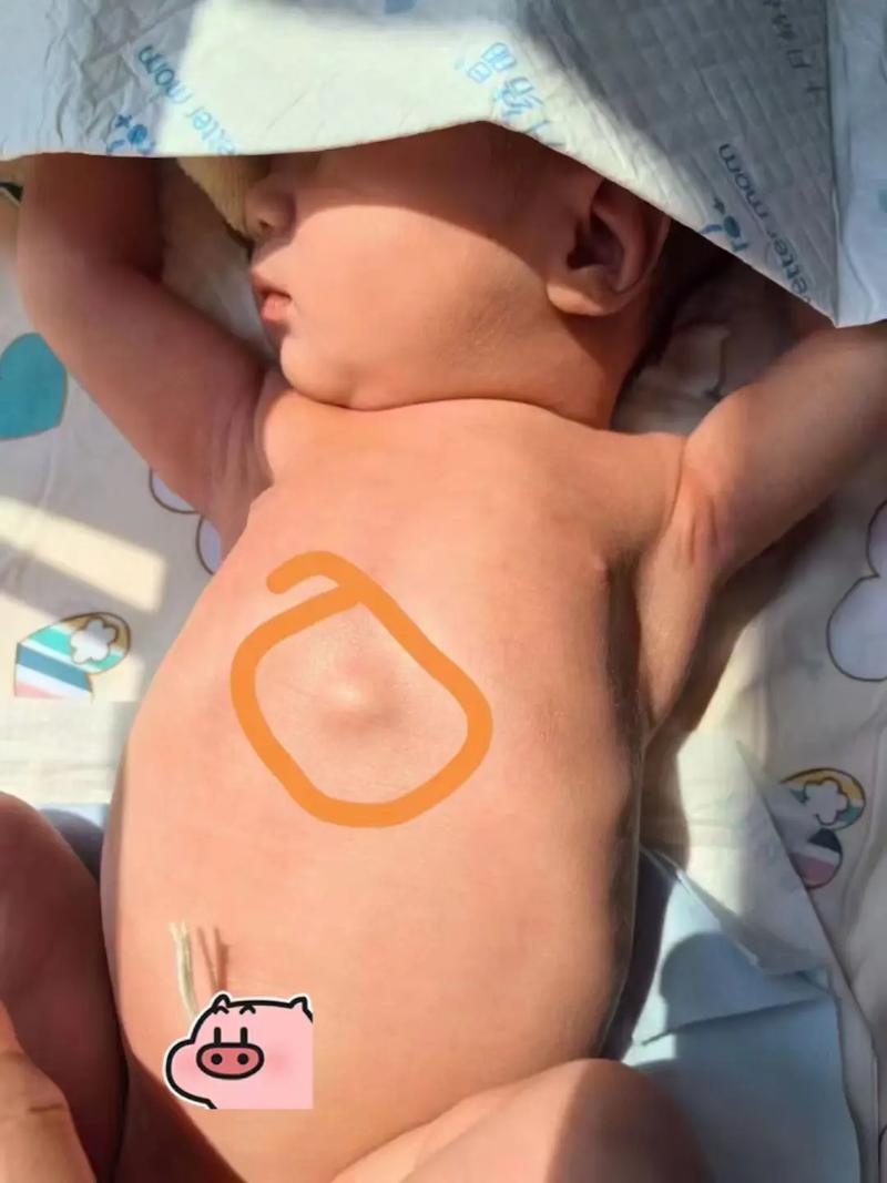 新生儿胸口中间凸起是何原因？-第1张图片-郑州医学网