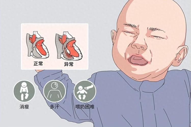 新生儿先天性心脏病有哪些典型表现？-第2张图片-郑州医学网
