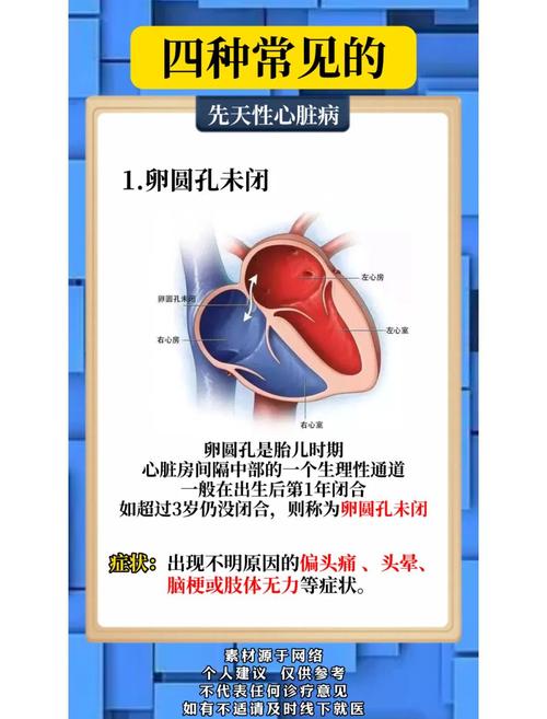 新生儿先天性心脏病有哪些典型表现？-第3张图片-郑州医学网
