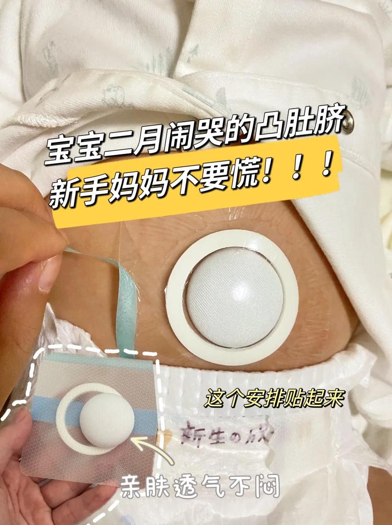 新生儿短肠50cm能存活吗？-第3张图片-郑州医学网