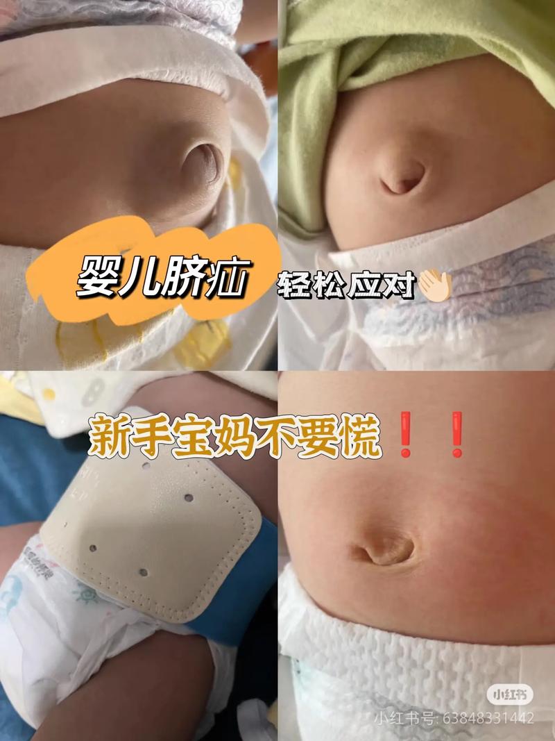 新生儿短肠50cm能存活吗？-第1张图片-郑州医学网