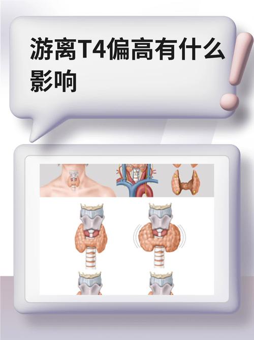 孕期游离T4偏低，该咋办？-第1张图片-郑州医学网