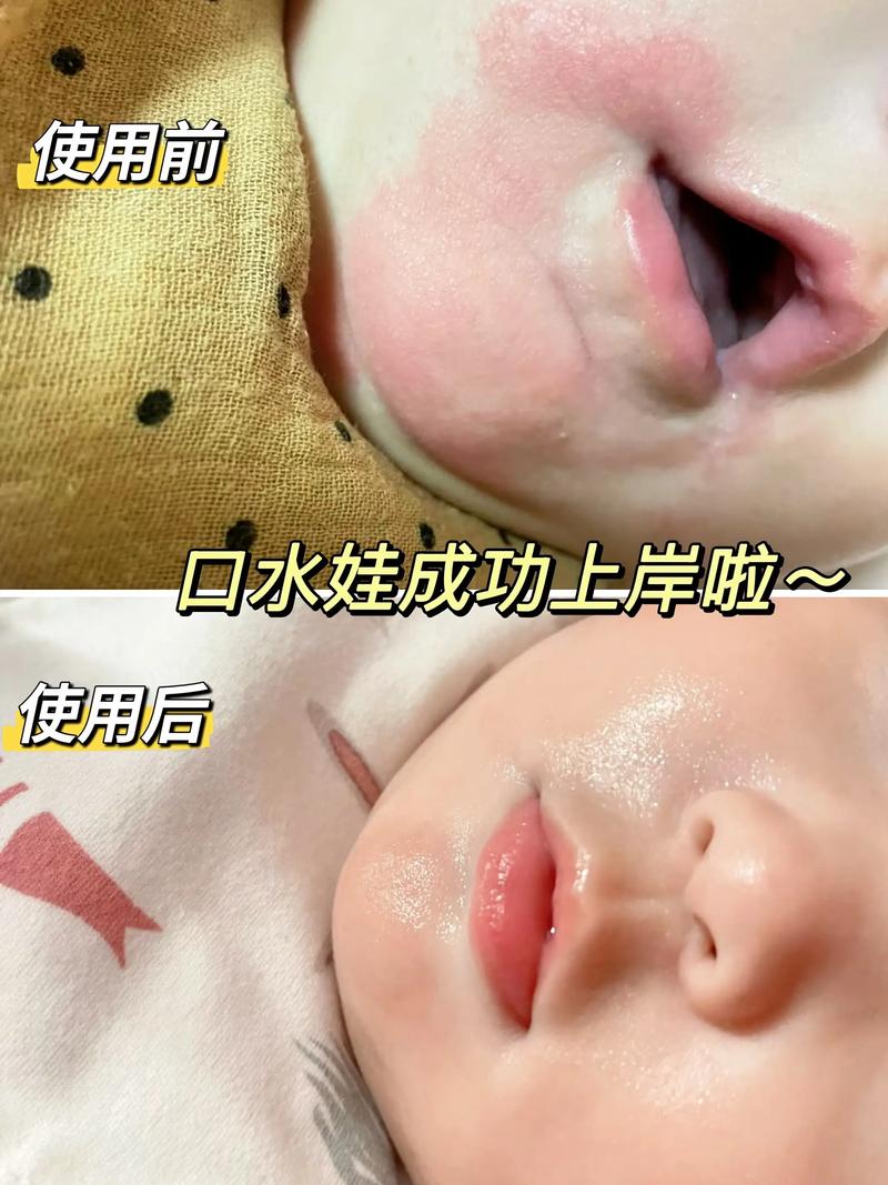 新生儿能用盐水洗嘴巴吗？-第1张图片-郑州医学网