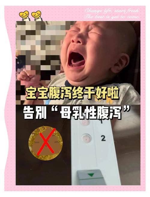 新生儿喝母乳拉肚子，需停母乳吗？-第3张图片-郑州医学网