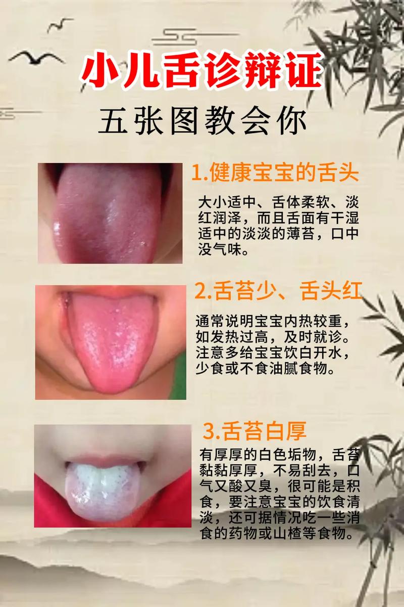 新生儿舌头发白是何原因？-第1张图片-郑州医学网
