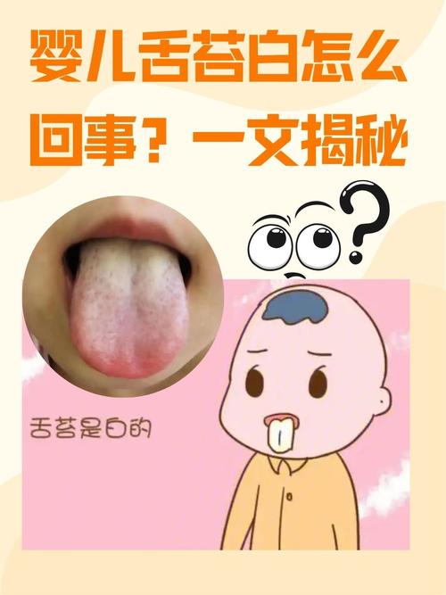新生儿舌头发白是何原因？-第2张图片-郑州医学网