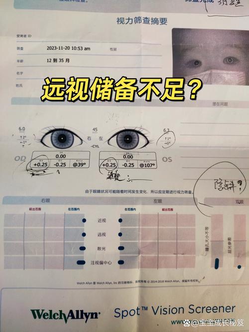 新生儿视力筛查何时做最合适？-第3张图片-郑州医学网