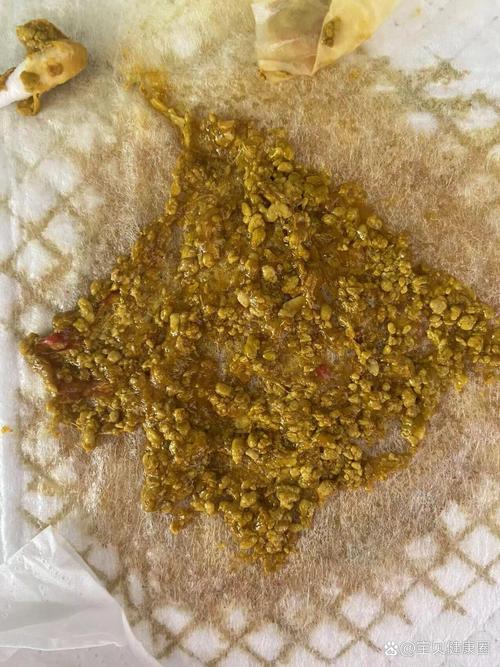 新生儿混合喂养大便有奶瓣怎么办？-第3张图片-郑州医学网