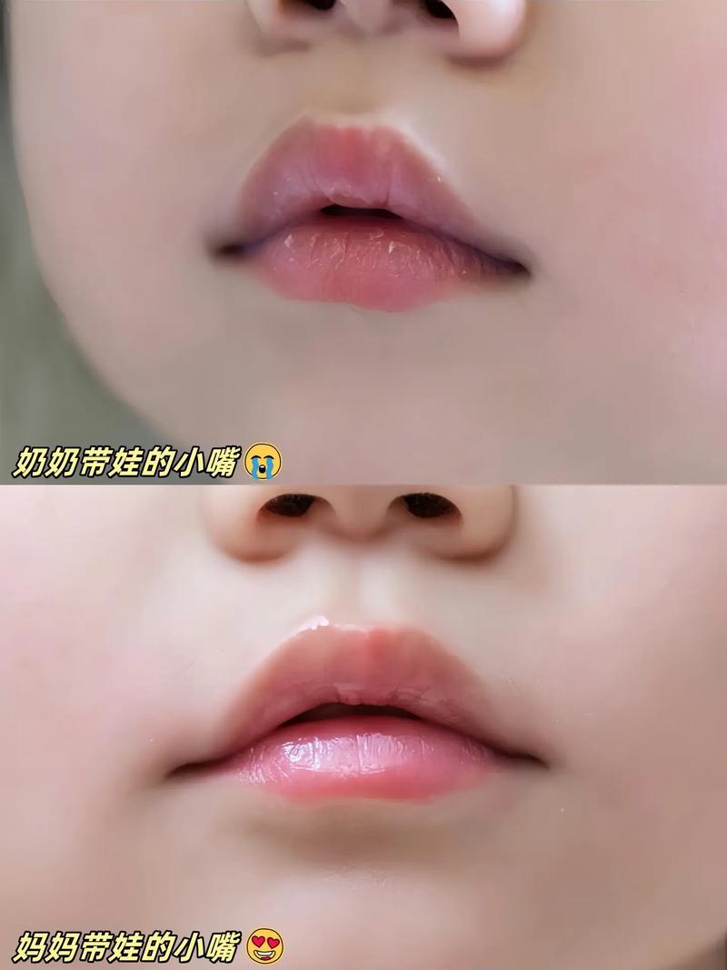新生儿嘴唇脱皮是何原因？-第3张图片-郑州医学网