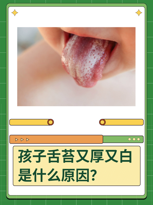新生儿舌苔白是何原因所致?-第1张图片-郑州医学网 新生儿舌苔白是何原因所致?-第1张图片-郑州医学网