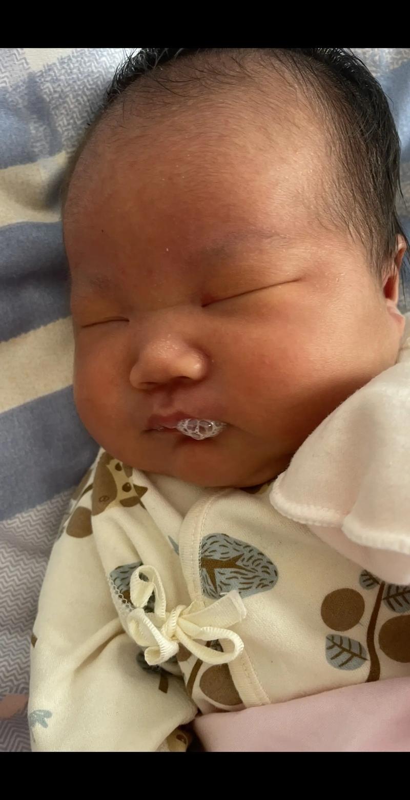 新生儿睡喉有痰是生病了吗?-第3张图片-郑州医学网 新生儿睡喉有痰是生病了吗?-第3张图片-郑州医学网
