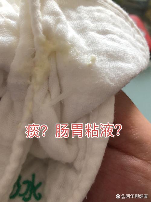 新生儿睡喉有痰是生病了吗?-第1张图片-郑州医学网 新生儿睡喉有痰是生病了吗?-第1张图片-郑州医学网