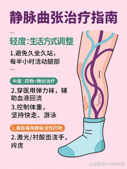 孕期腿部静脉曲张如何缓解?-第3张图片-郑州医学网 孕期腿部静脉曲张如何缓解?-第3张图片-郑州医学网