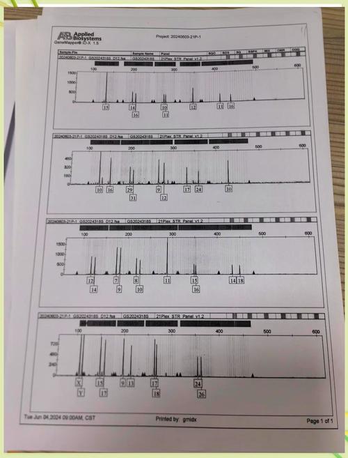 怀孕期间做DNA亲子鉴定准确吗?-第3张图片-郑州医学网 怀孕期间做DNA亲子鉴定准确吗?-第3张图片-郑州医学网