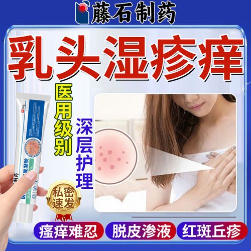 孕期乳房湿疹用什么药安全有效?-第3张图片-郑州医学网 孕期乳房湿疹用什么药安全有效?-第3张图片-郑州医学网