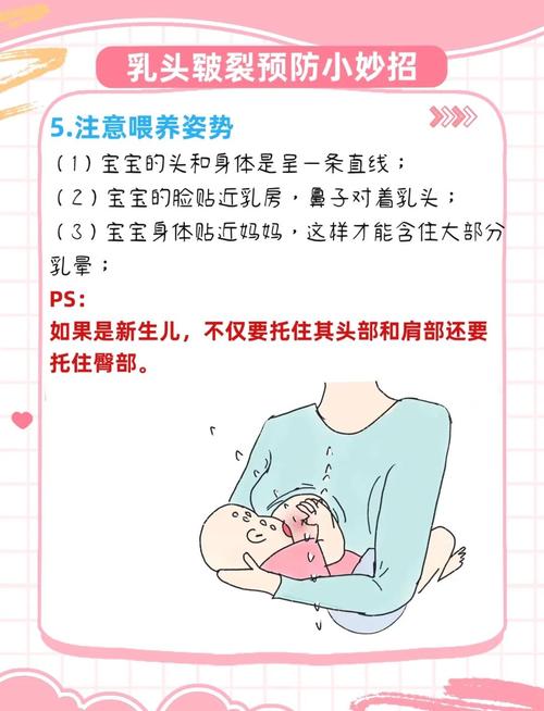 新生儿乳头硬块是正常现象吗？-第3张图片-郑州医学网