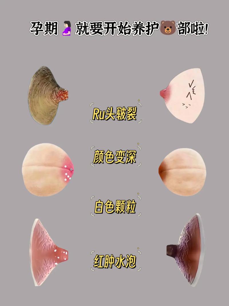 新生儿乳头硬块是正常现象吗？-第2张图片-郑州医学网