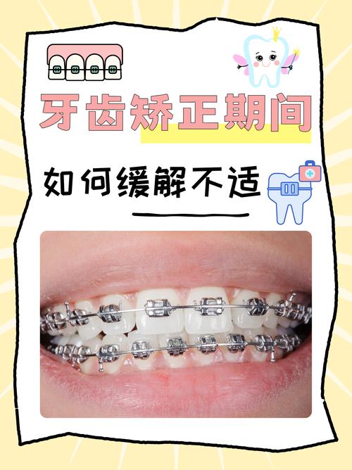 怀孕期间可以矫正牙齿吗-第2张图片-郑州医学网 怀孕期间可以矫正牙齿吗-第2张图片-郑州医学网