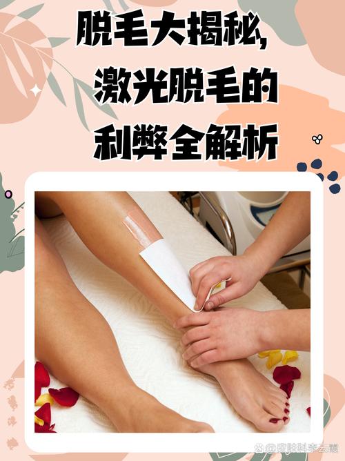 孕期激光脱毛安全吗？-第3张图片-郑州医学网