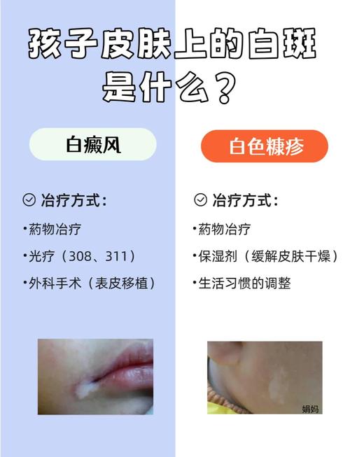 新生儿脸上白点点是啥原因？-第2张图片-郑州医学网