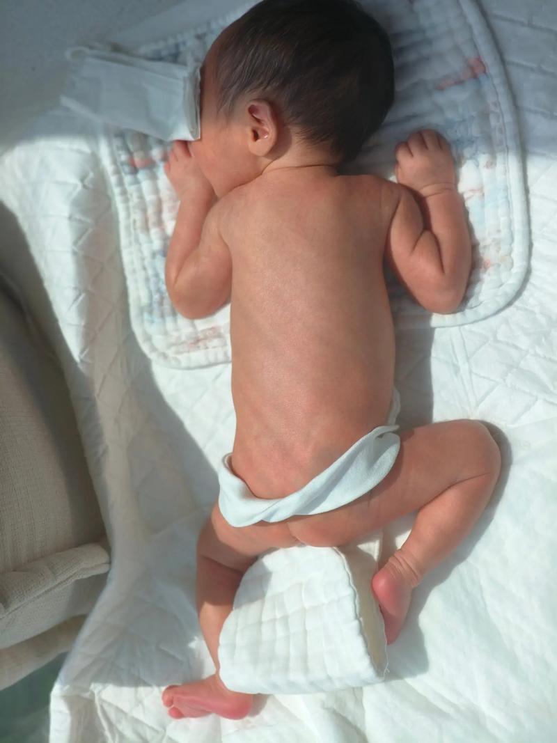 新生儿晒黄疸,晒多久、怎么晒才正确?-第3张图片-郑州医学网 新生儿晒黄疸,晒多久、怎么晒才正确?-第3张图片-郑州医学网