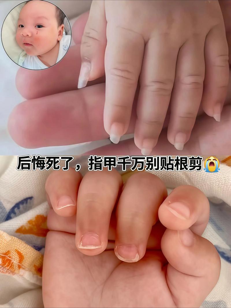 新生儿出生多久可以剪指甲-第2张图片-郑州医学网