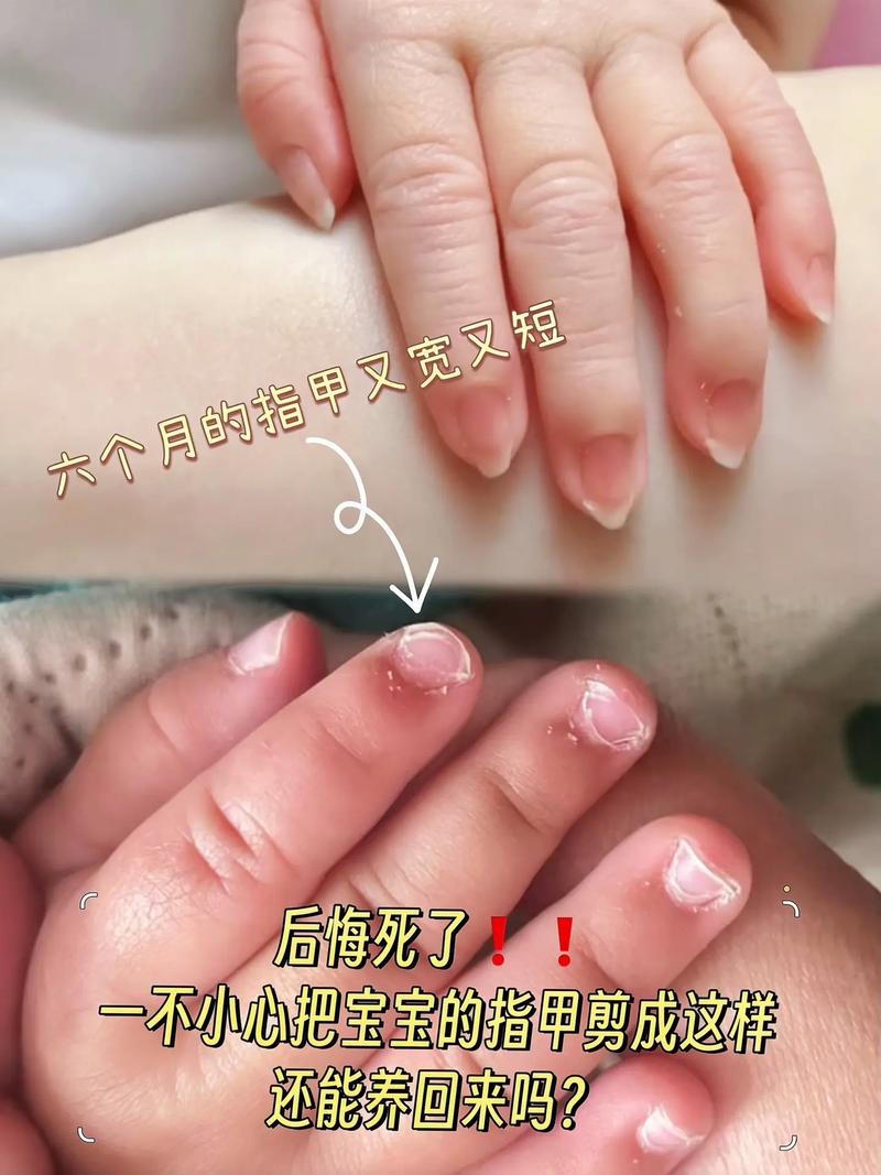 新生儿出生多久可以剪指甲-第1张图片-郑州医学网