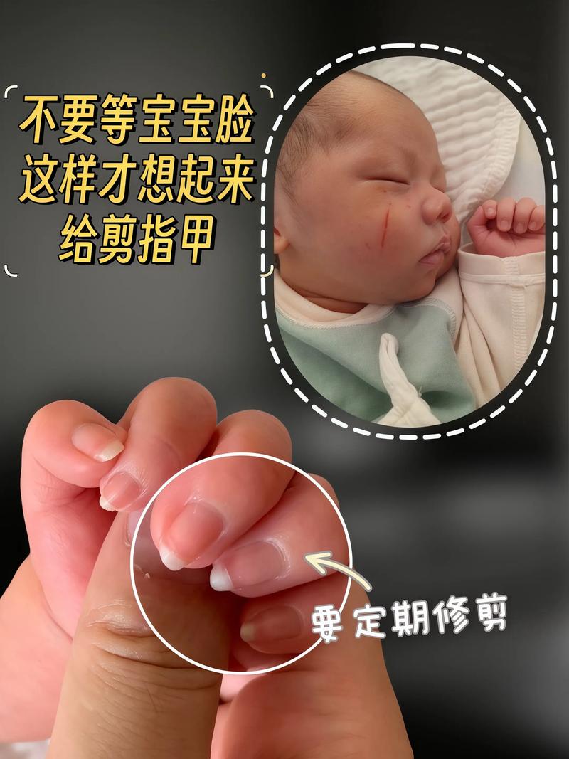 新生儿出生多久可以剪指甲-第3张图片-郑州医学网