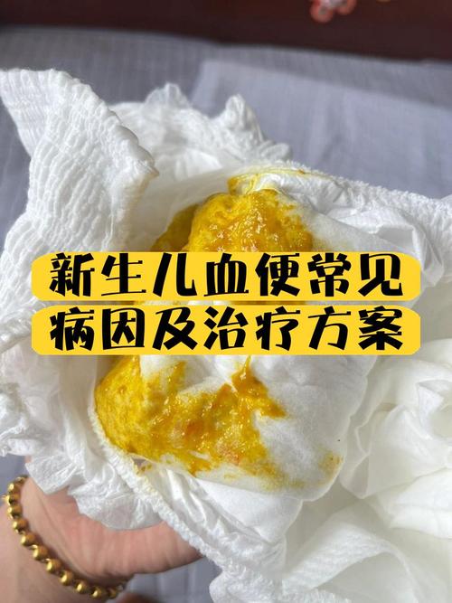 新生儿大便带血是何原因?-第1张图片-郑州医学网 新生儿大便带血是何原因?-第1张图片-郑州医学网